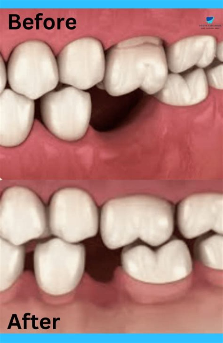 Why are my teeth moving as I get older?