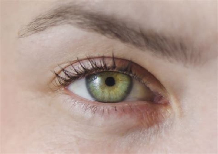 Why are scars eyes green?
