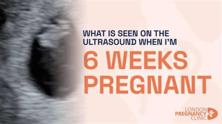 Why do I feel flutters in my stomach at 12 weeks?
