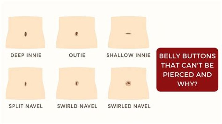 Why is my belly button moist?