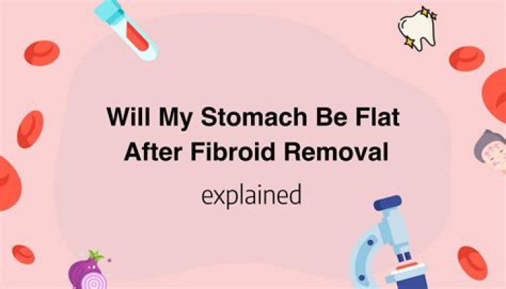 Will my stomach go down after fibroid removal?