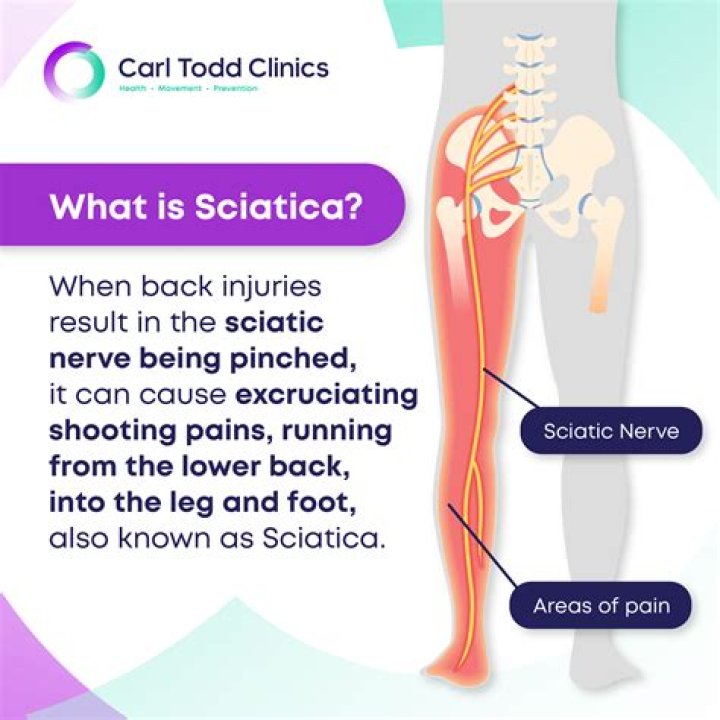 Will sciatica ever go away?